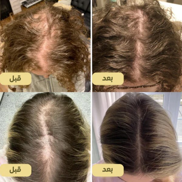⁦عرض فرشاة التيكتوك المشهورة + زيت الشعر الطبيعي EELHOE⁩ - الصورة ⁦5⁩